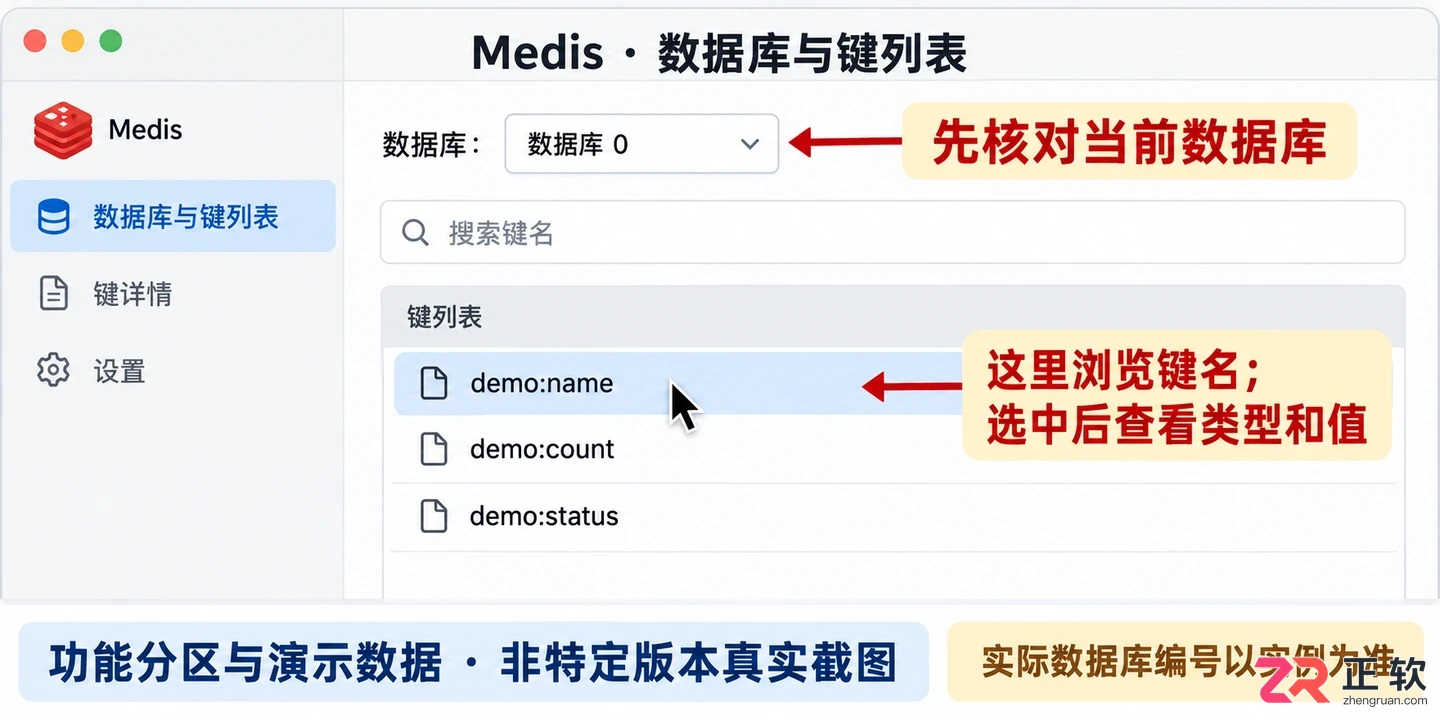 medis中文设置教程详解新手操作步骤指南