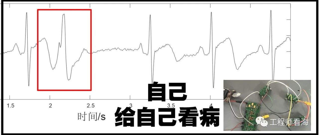 工程师病了?自己动手做心电图检测电路,顺便测一下心跳!