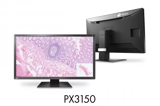 艺卓推出首款4096×2160分辨率病理图像显示器PX3150